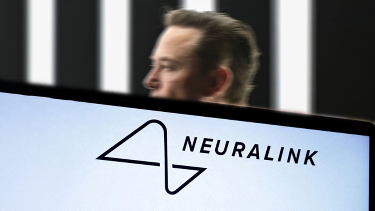 Chip Implanted In The Brain: Will Musk’s Challenge Be A Blessing?